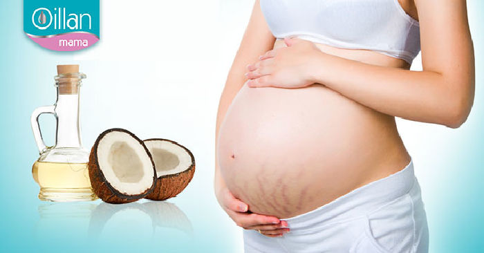 Treatment of stretch marks