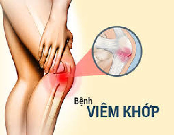 Bath arthritis cure